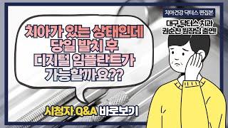 치아가 있을때도 당일식립 임플란트가 가능할까?? 발치 후 임플란트! 직접 궁금함을 풀어보세요!