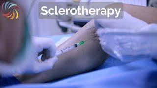 Sclerotherapy