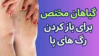 گیاهان خاص مخصوص باز کردن رگ های پا در بدن