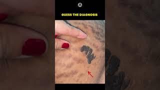 Guess the Diagnosis #diagnosis #casestudy #clinicalcase