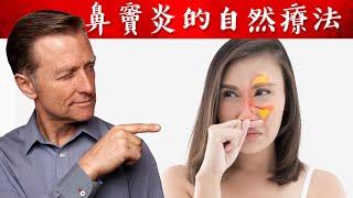 鼻竇炎的自然療法,柏格醫生 Dr Berg