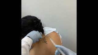 Dr. Gendai Echezona Treating Neck Pain with Trigger Point Injections in Norwalk CT