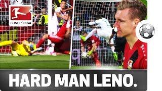 Ouch! - Keeper Leno Takes One for the Team Again