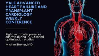 Right ventricular pressure analysis during LVAD speed optimization studies