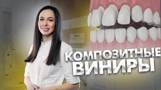 Композитные виниры. ВИНИРЫ. Стоматология. Всё про композитные виниры.