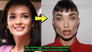 Amy Jackson Looks Unrecognizable after her shocking Plastic Surgery, fillers and Botox