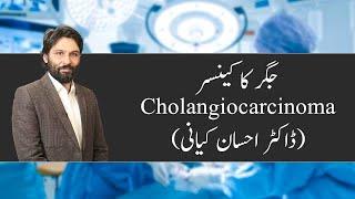 Dr Ahsaan kiani | Cholangiocarcinoma | Bile Duct Cancer | Dr. Faisal Dar's Team