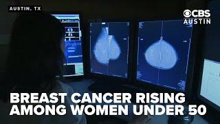 "The youngest one was 22," new report finds rise in breast cancer rates in women under 50