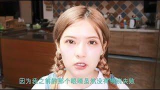 双眼皮修复分享，20岁女子割双眼皮失败，从肉条松弛到闭眼无痕