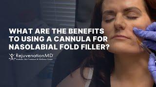 Cannula Artistry: Transforming Nasolabial Folds with Filler