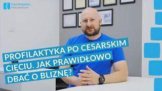 Profilaktyka po cesarskim cięciu. Jak prawidłowo dbać o bliznę? | Fizjoterapia Maciej Stachurski