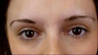 Women Turn to Eyebrow Transplants for Fuller Brows