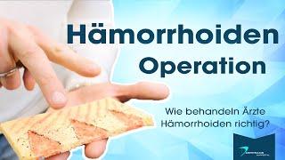 Operative Behandlung von Hämorrhoiden | Dr. Eduard Karsten