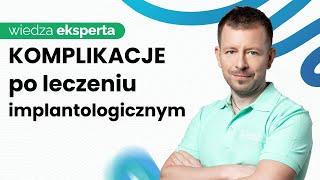 Możliwe Komplikacje Po Wszczepieniu Implantów - Co Warto Wiedzieć?