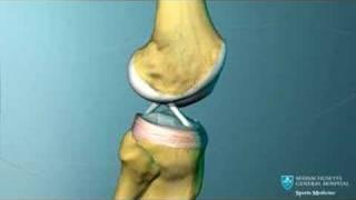 Knee Ligament Anatomy Animation