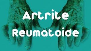 CONHEÇA MAIS SOBRE A ARTRITE REUMATOIDE | Reumatocare