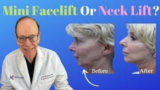 Reasons for a Mini Facelift or Neck Lift Surgery | Plastic Surgeon's Opinion