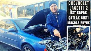 Chevrolet Lacetti 2 -Tespitimiz Doğru Çıktı Masraf Büyük