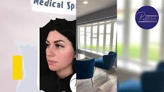 Dermaplaning in Racine by Renew Medical 53404