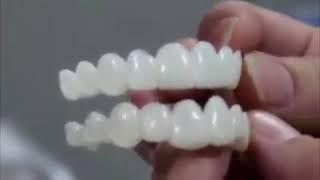 Perfect Smile Veneers