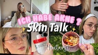 SKINCARE TALK, ICH HABE AKNE?, HAUTARZT - Wochenvlog | Hannah Theresa