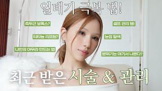 최근 받은 시술 모두 공개!나만의 아우라& 분위기 만드는 법, 셀프 관리 | 얼굴 작아지는 시술, 인생 붓기 관리템, 화장실 잘가는 템, 한끗차이로 달라지는 법!
