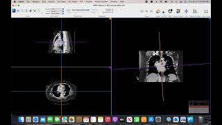 DICOM viewer for Apple - Using Horos