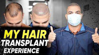 Hair Transplant in Bhopal | Best Results & Cost of Hair Transplant in Bhopal