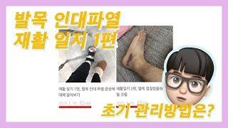 발목 인대파열 재활 과정 1편, 초기 관리방법 알아보기