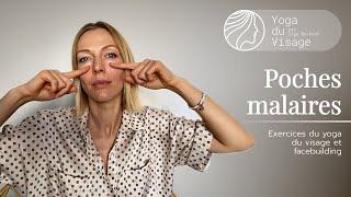 Poches malaires (malar bags) & traitement naturel | Yoga du Visage | Facebuilding