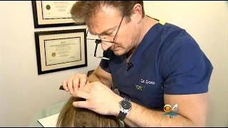 More Younger Women Losing Hair Over Stress