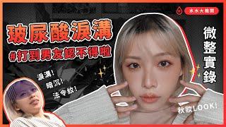 【玻尿酸實錄】打完淚溝超後悔？！怎麼現在才鼓起勇氣！ feat.彩妝師Ginger