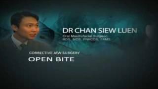 Open Bite Causing Eating and Speech problems? Makeover of a young man with Open Bite.