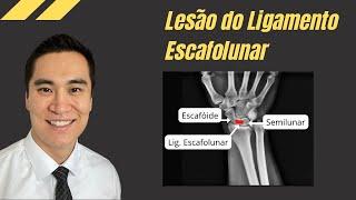 Dangerous and silent! Injury of the scapholunate or scapholunate ligament