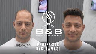 PROTEZ SAÇ UYGULAMASI