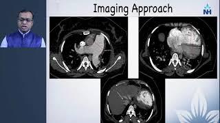 CT Imaging of Pulmonary Hypertension an introduction