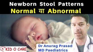 Newborn Stool Problems | Frequency Consistency Colour | Dr Anurag Prasad | vlog10