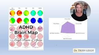 What Does the ADHD Brain Map Look Like?