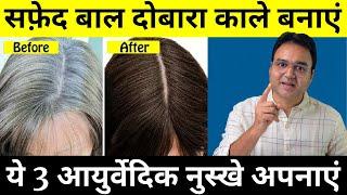 यह तीन चीज़ें 30 दिन लगाओ सारे सफेद बाल काले हो जाएंगे | White Hair To Black Hair Naturally