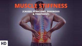 Muscle Stiffness Unpacked: An Expert Discussion