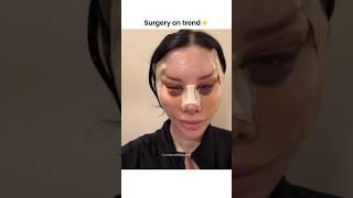 full face surgery#shorts #cosmeticsurgery #beauty