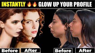 Facial Balancing with Chin Fillers- GAME CHANGING!- Instant Profile Glow Up!