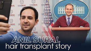 WHITE HOUSE CORRESPONDENT ANIL SURAL HAIR TRANSPLANT JOURNEY | HairNeva