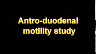 What Is The Definition Of Antro duodenal motility study Medical Dictionary Free Online