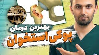 درمان پوکی استخوان و پیشگیری از آن | Osteoporosis prevention and treatment