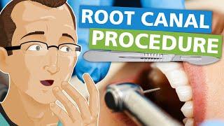 Root Canal Procedure