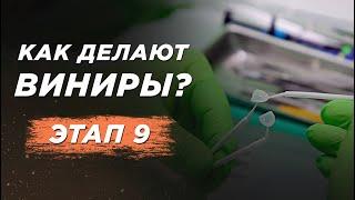 ВИНИРЫ. Этап 9. Фиксация виниров. Виниры для зубов