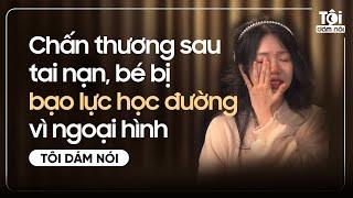 Chấn thương sau tai nạn, bé bị B.ẠO L.ỰC HỌC ĐƯỜNG vì ngoại hình | TÔI DÁM NÓI