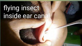 !!Something disturbing inside his ear canal !! || 昆虫  Konchū ||