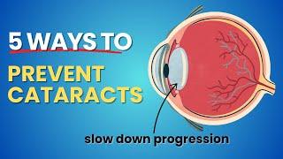 5 Secrets to Delay Cataracts (Your Eyes Will Thank You)